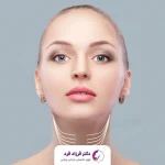 معجزه زیبایی با عمل لیفت گردن