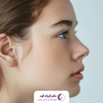 طراحی بینی قبل از جراحی