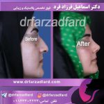 نمونه‌کار جراحی بینی