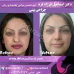 نمونه‌کار جراحی بینی