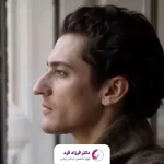 عمل بینی عقابی در مشهد