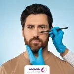 قبل از عمل بینی چه باید کرد؟ بررسی کامل مراقبت های عمل بینی