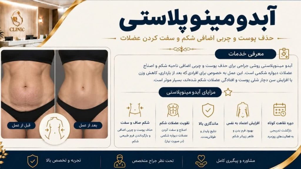 آبدومینوپلاستی - دکتر اسماعیل فرزادفرد